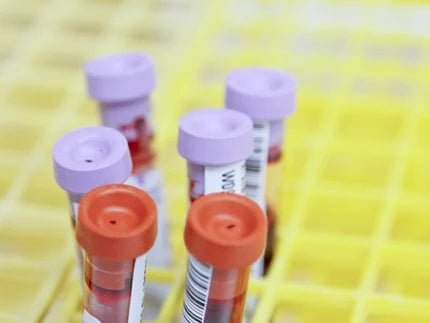 Gold-standard IgE testing — brought directly to your home