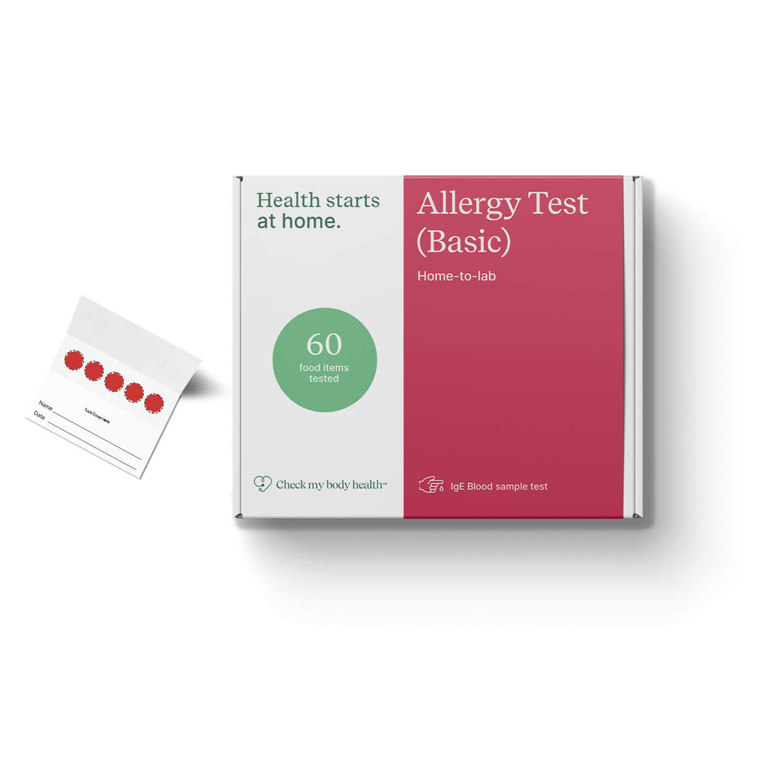 Allergy Test (Basic)